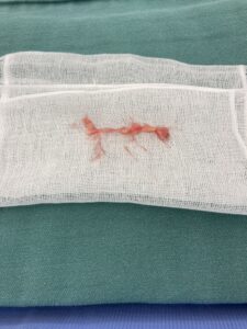 375D7DBD-39C6-40EB-B9B3-3AA16687AF26